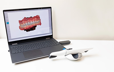 intraoral scanner used at Central Virginia Family Dentistry